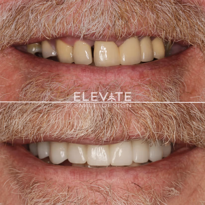 c5e953f1a6f9633c14025ac6f208401f9b3456b5-1500x1500